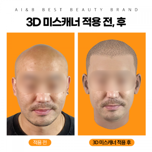 3D미스캐너2.png