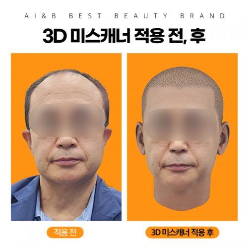 3D미스캐너3.png