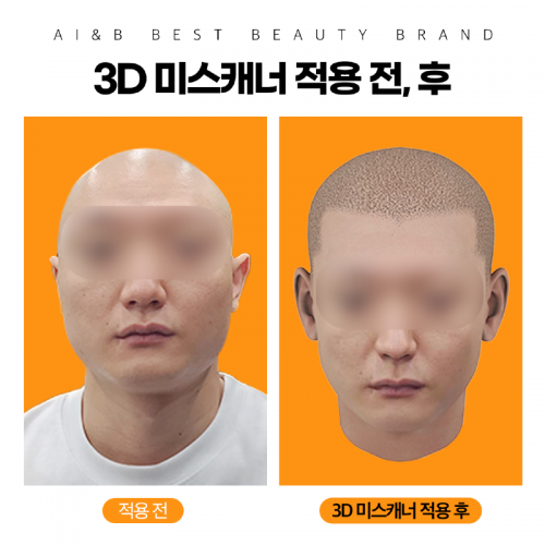 3D미스캐너4.png