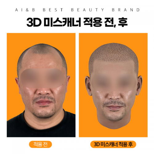 3D미스캐너6.png